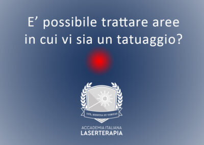 E’ possibile trattare aree in cui vi sia un tatuaggio?